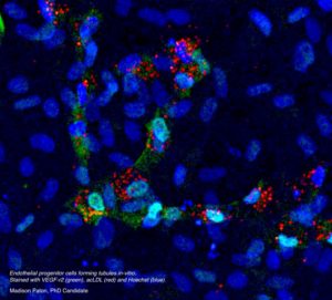 VEFG H LDL EPC Culture Bright-2