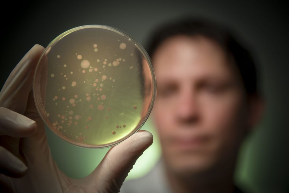 Dr Samuel Forster holding a bacterial agar plate showing anaerobic bacteria at the Hudson Institute