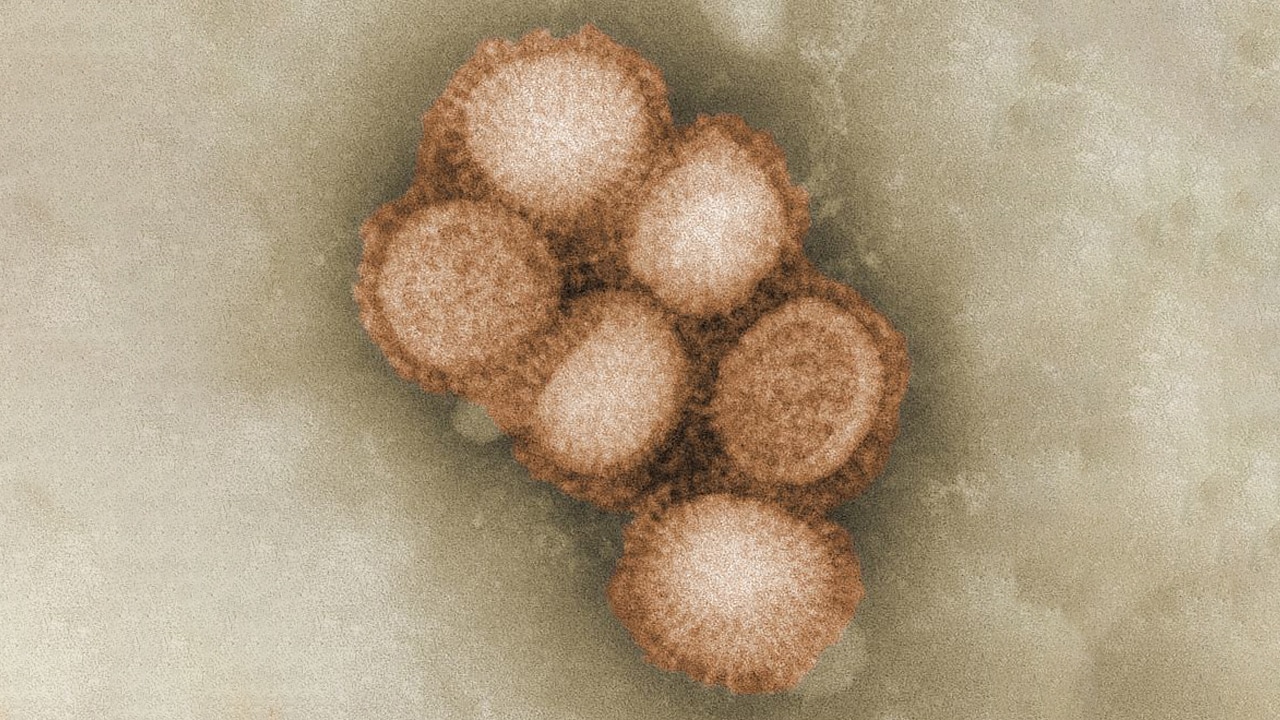 Influenza virus. Photo Credit: C. S. Goldsmith and A. Balish, CDC