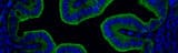 The immunofluorescence image is one of the mouse Fallopian tube showing IFNe expression (in green)