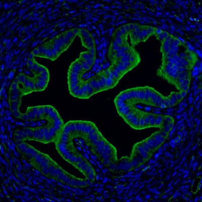 The immunofluorescence image is one of the mouse Fallopian tube showing IFNe expression (in green)