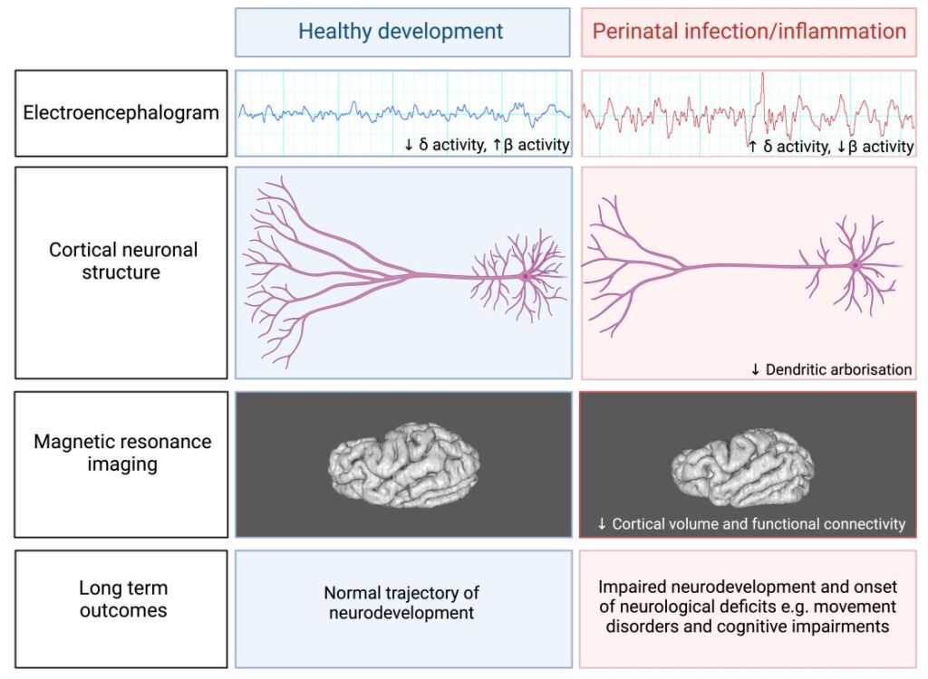 Rob and Sharmony perinatal brain inflammation