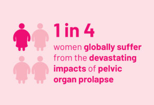 1 in 4 women globally suffer from the devastating impacts of pelvic organ prolapse