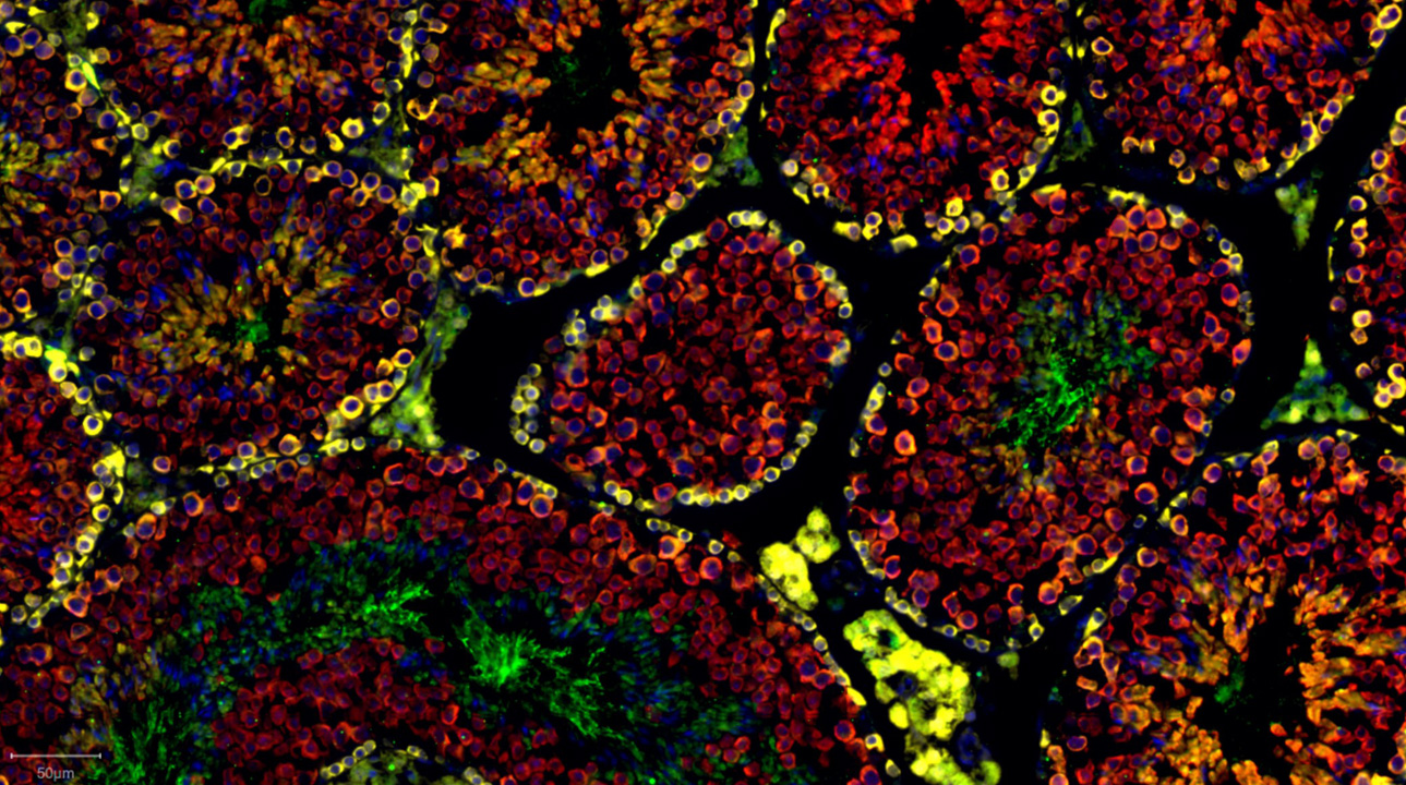 Distribution of importin 5 (IPO5) protein (in red) and two spermatogonial markers GILZ (in yellow) and GFRA1 (in green) in normal testis.
