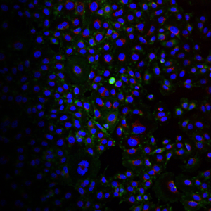H. pylori EVs labelled to detect Tipa (green) localised to a gastric epithelial cell undergoing cell division. Blue indicates the cell nucleus. Red indicates the golgi apparatus.