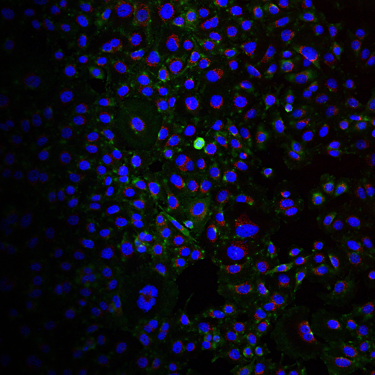 H. pylori EVs labelled to detect Tipa (green) localised to a gastric epithelial cell undergoing cell division. Blue indicates the cell nucleus. Red indicates the golgi apparatus.