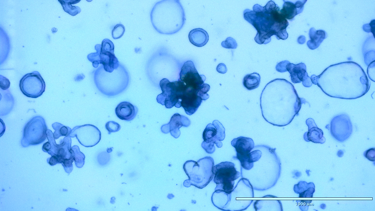 Intestinal organoids - Image Credit: Monash University