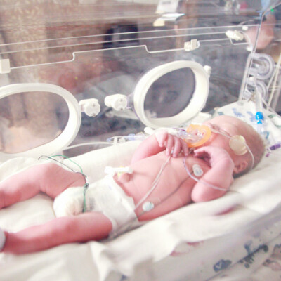 Preterm Baby