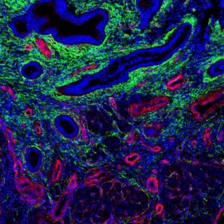 Endometrial Cells
